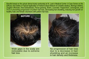 Novuhair review discount
