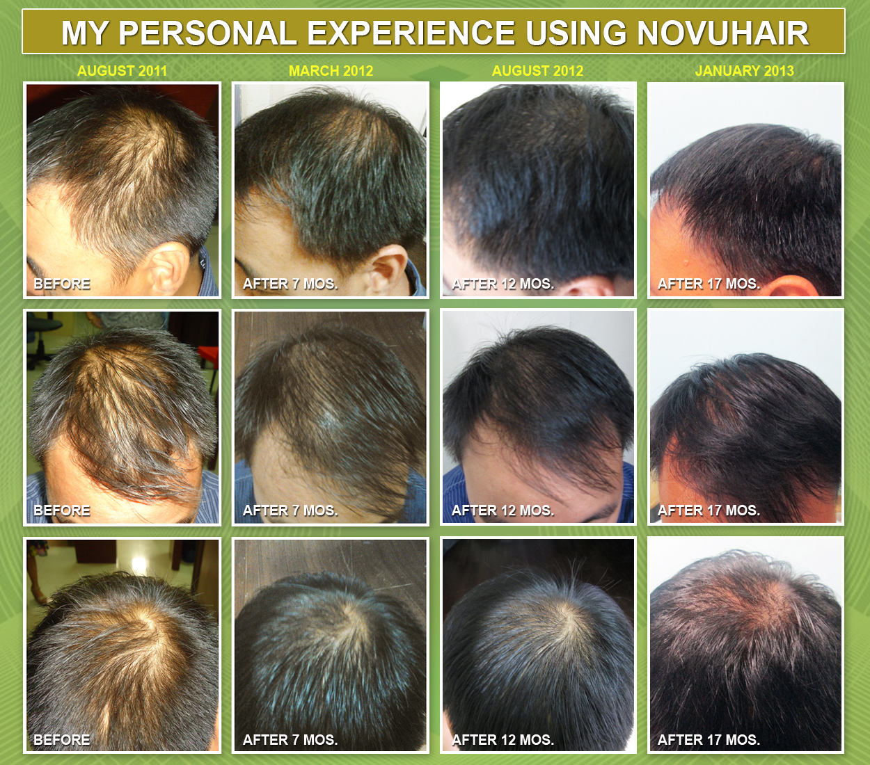 Personal Discovery Using NOVUHAIR by Raymond Domingo