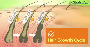 What's the Difference Between Hair Loss and Hair Shedding? - NOVUHAIR®