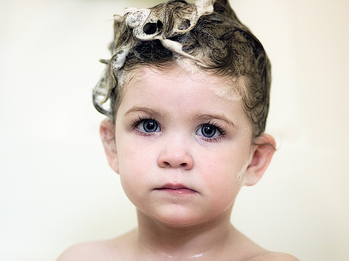 Hair Loss in Children: How to Treat It? - NOVUHAIR®