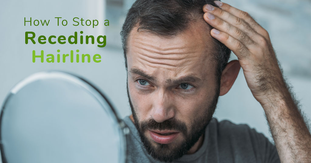 How To Stop a Receding Hairline